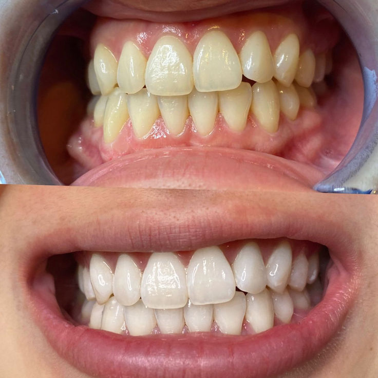 Estética Dental
