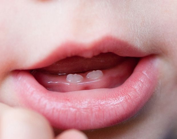 Odontopediatria